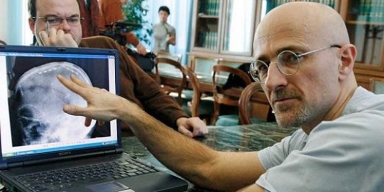 Sergio Canavero