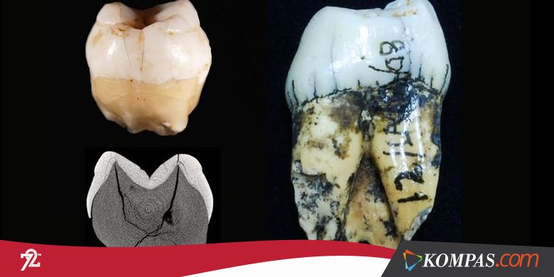 Manusia Pertama Penghuni Indonesia Diungkap, Gigi Ini Jejaknya