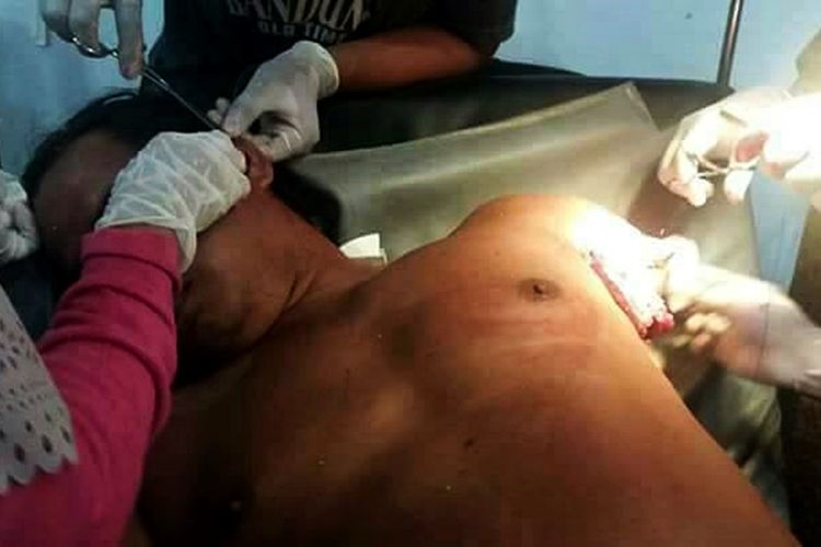 (Foro Sayid) Tahir warga Desa Pembeliangan Kabupaten Nunukan ang menjadi korban penyerangan buaya sepanjang 7 meter di Sunagi Sebuku. Akibat serangan tersebut, tangan kiri Tahir putus hingga lengan atas. Sepanjang Sungai Sebuku memnag terkenal sebagai habitat buaya muara.