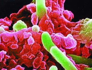 10 Bakteri Yang Menguntungkan Bagi Manusia [ www.BlogApaAja.com ]