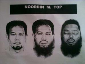 Kerusakan Dubur Noordin M Top Disengaja? 