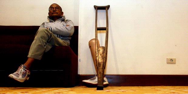 Berita Foto: Berjalan Lagi dengan Kaki Palsu