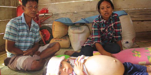 Tumor Ganas, Perut Bocah 8 Tahun Ini Membesar 1358264620X310 Tumor Ganas, Perut Bocah 8 Tahun Ini Membesar