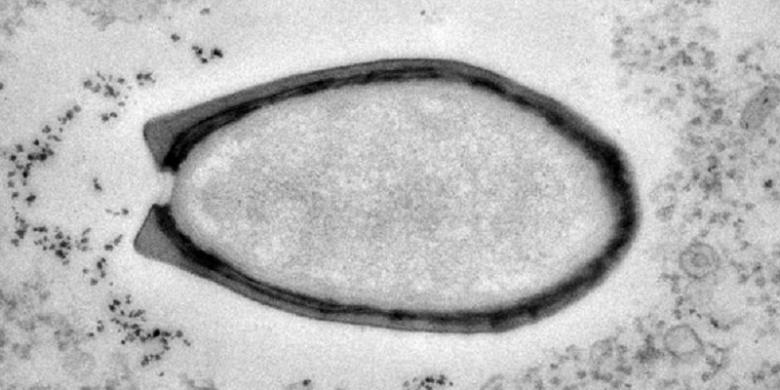Beku Puluhan Ribu Tahun, Virus ini Masih Dapat Meinfeksi Manusia