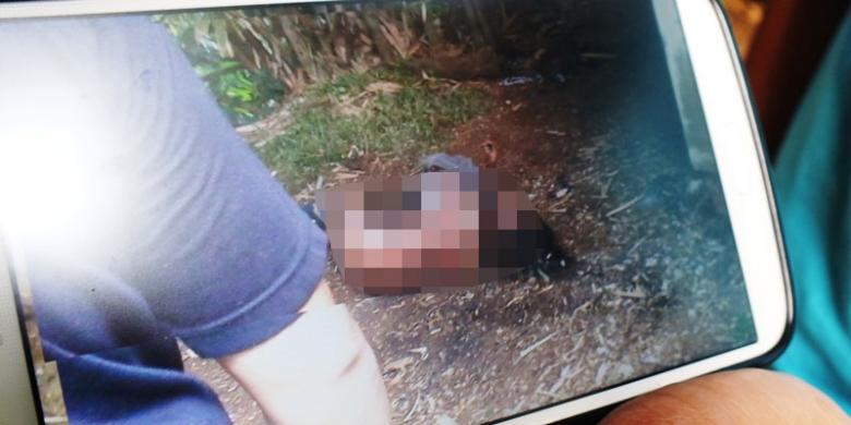 Foto kondisi Tari Handayani (21), warga Kampung Cilubang, Bubulak, Kecamatan Bogor Barat, Kota Bogor, saat dirinya terbakar disebuah rumah kosong, di Kampung Cikiray, RT 01/06, Desa Sukaraja, Kecamatan Sukaraja, Kabupaten Bogor, Rabu (10/9/2014).