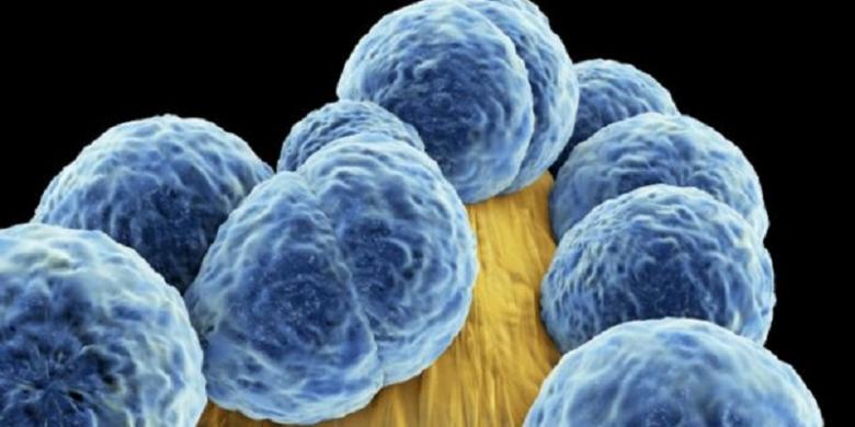 BBC/Science Photo Library