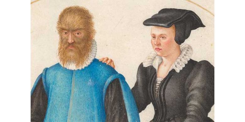 Petrus Gonsalvus dan Catherine, pasangan Beauty and the Beast sesungguhnya. 